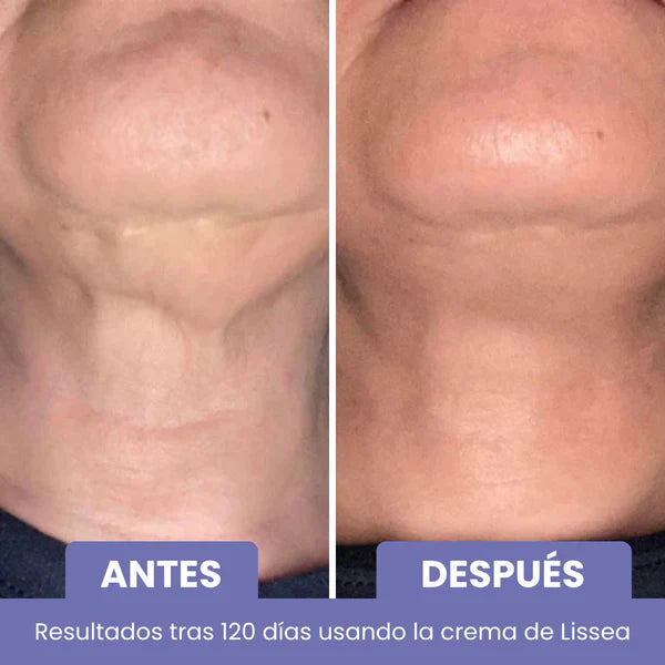 Élan – Cuello y escote más firmes, suaves y radiantes