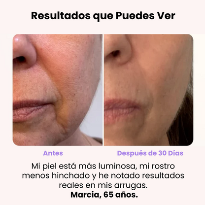 DermaGlow 4D -  Masajeador Reductor de Arrugas - [PROMOCIÓN DISPONIBLE SOLO HOY]