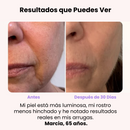 DermaGlow 4D -  Masajeador Reductor de Arrugas - [PROMOCIÓN DISPONIBLE SOLO HOY]