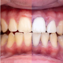 GlumiWhite - Blanqueador V34 - [PROMOCIÓN DISPONIBLE SOLO HOY]