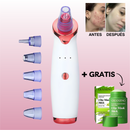 Pure Skin Limpiador de Puntos Negros + Green Mask Stick Mascarilla Té Verde GRATIS - [PROMOCIÓN DISPONIBLE SOLO HOY]