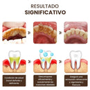Blanqué – Blanqueamiento potente, sonrisa impecable
