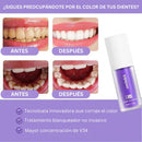 Sérum Blanqueador Dental | V34 BrightSmile Sonrisa Radiante